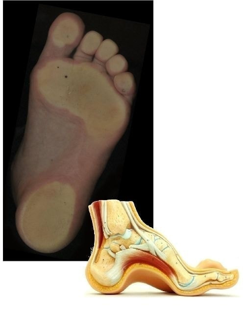 ハイアーチの足の画像