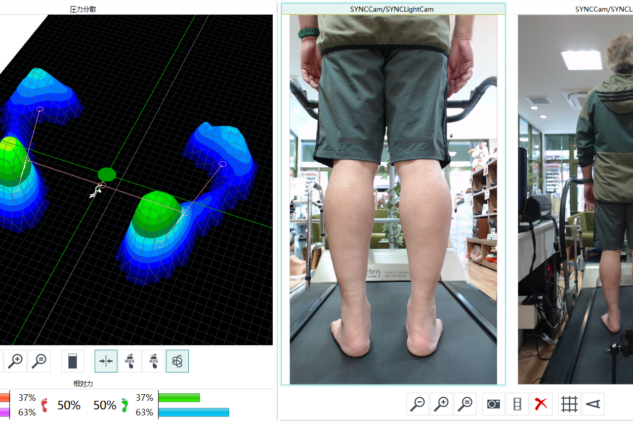 足の機械計測の画像