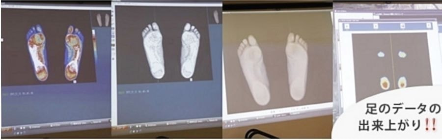 足を計測している画像